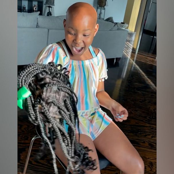 How 'Hair Queen' schoolgirl hit by alopecia is now helping other kids -  Birmingham Live
