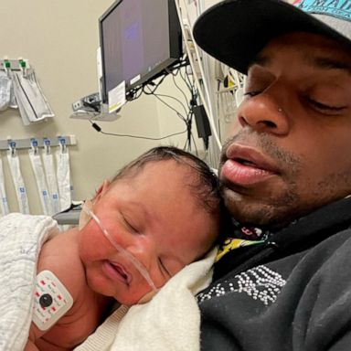 VIDEO: Jimmie Allen and his wife reflect on daughter's RSV battle 1 year later