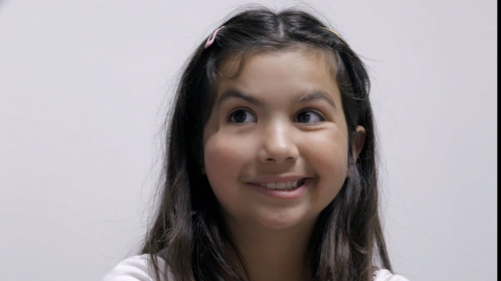 VIDEO: 11-year-old girl gets a new smile after facial paralysis surgery