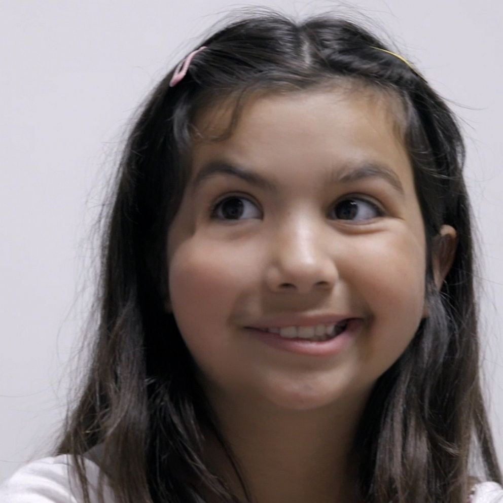 11 Year Old Girl Gets A New Smile After Facial Paralysis Surgery Good