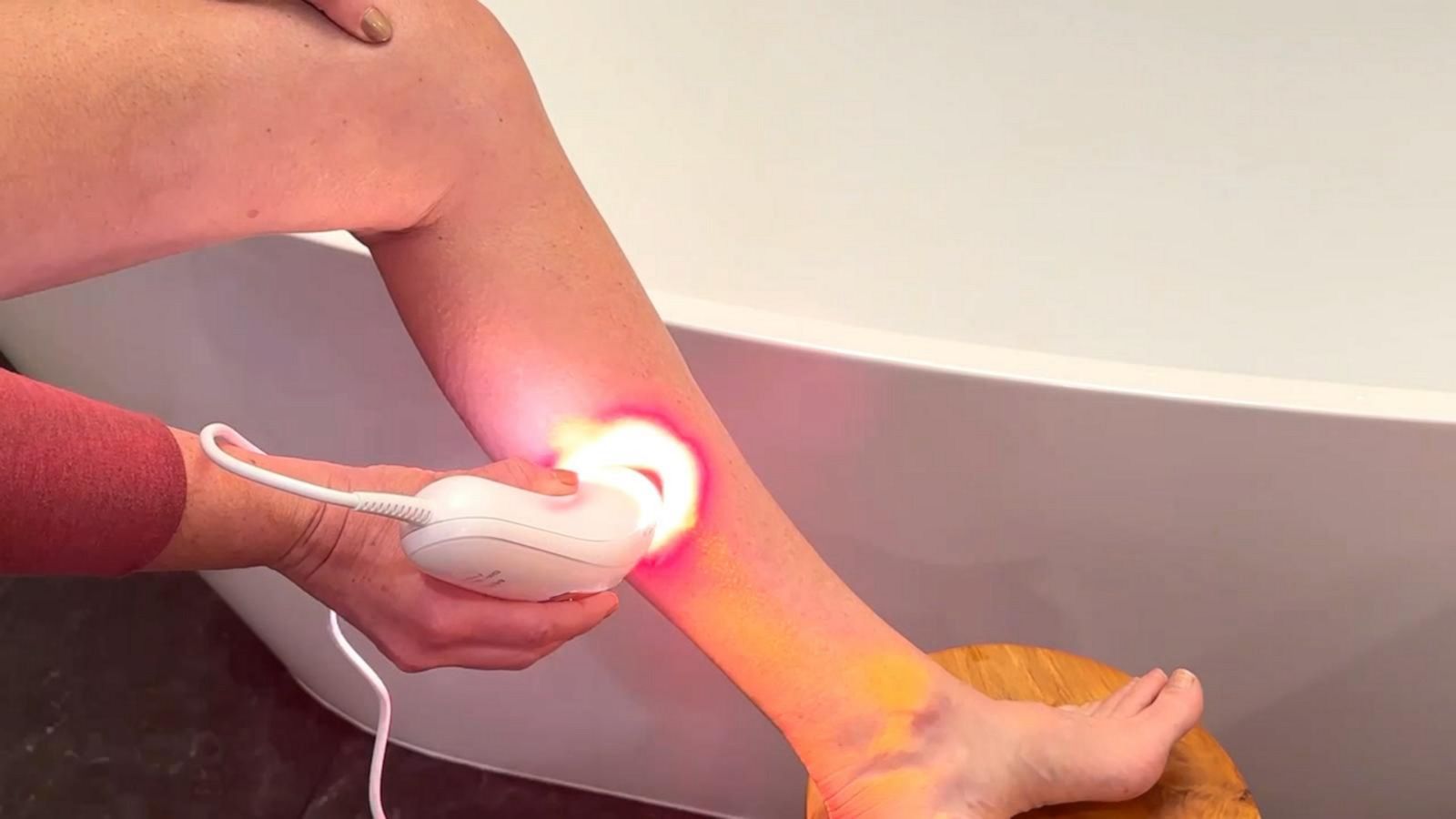 Testing at-home laser hair removal devices - Good Morning America