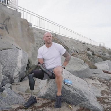 VIDEO: Shark attack survivor shares his story