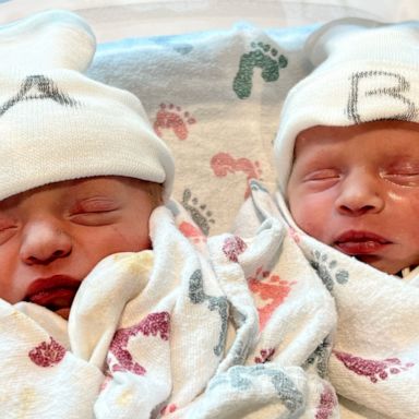 VIDEO: These fraternal twin sisters were born on different days in different years 