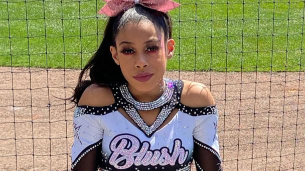 Cheerleader bounces back from heart surgery, News Services