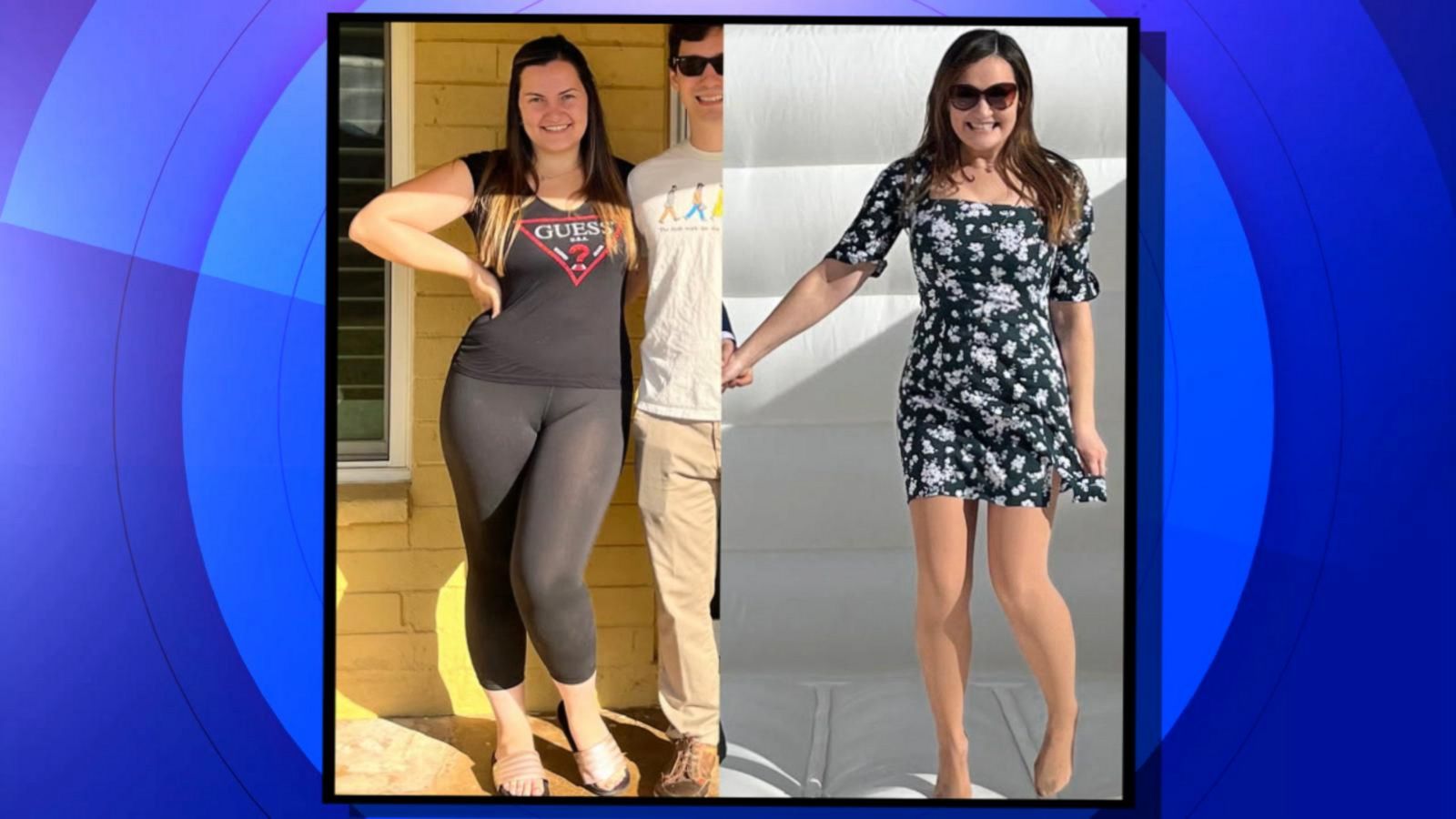 woman-shares-journey-of-weight-loss-and-gain-after-using-semaglutide-good-morning-america