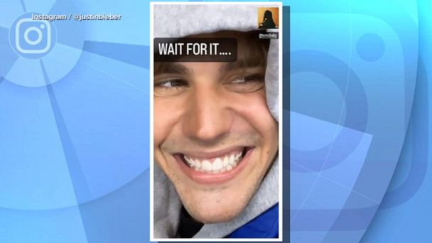 Justin Bieber postpones shows after he tests positive for COVID-19 - ABC  News