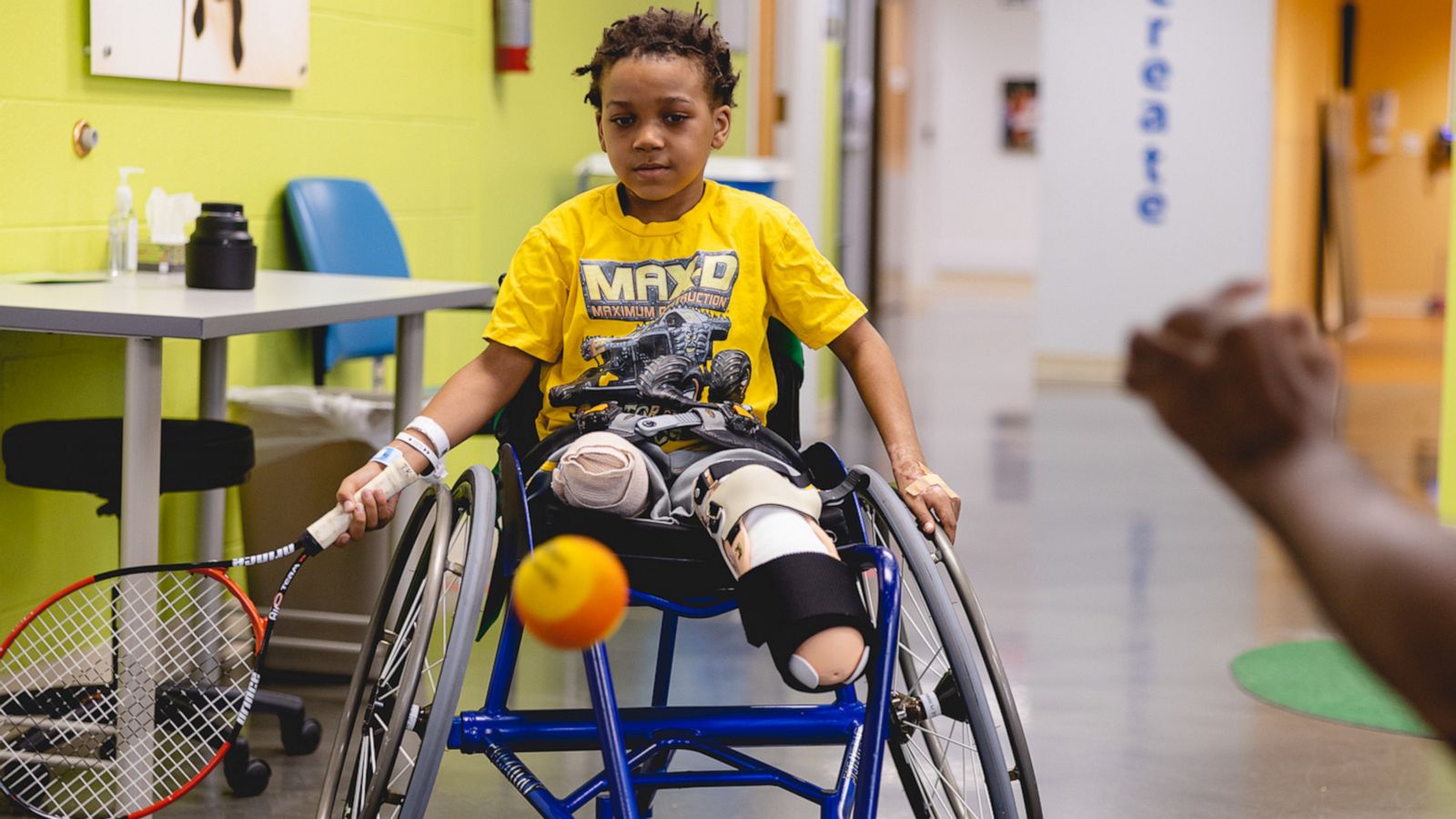 VIDEO: Michigan boy had both of his legs amputated after strep and influenza A infections