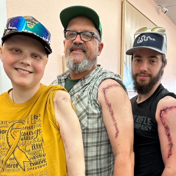 Family gets tattoo to match sons scar from cancer treatment  Good Morning  America