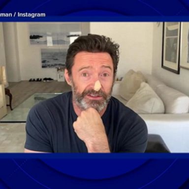 VIDEO: Hugh Jackman urges sunscreen use after skin cancer scare