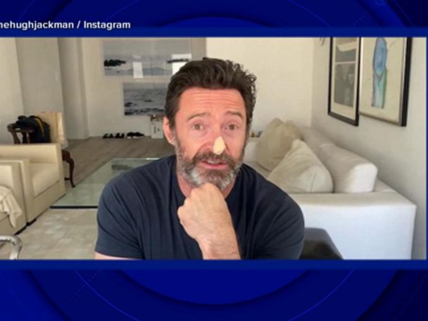 Hugh Jackman Continues His Personal Sunscreen PSA After Another