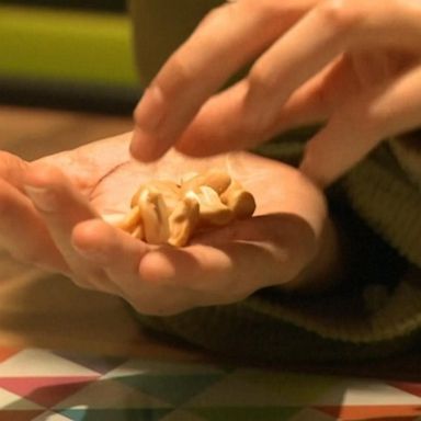 VIDEO: Experimental patch shows promise for kids with peanut allergies