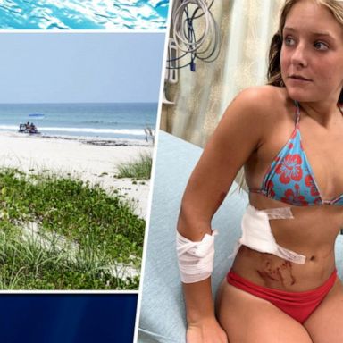 VIDEO: 13-year-old recounts fighting off shark attack