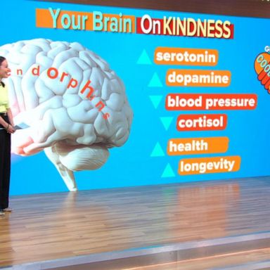 VIDEO: How kindness can have positive effects on your brain