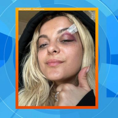 VIDEO: Bebe Rexha returns to stage after being hit with cellphone during performance