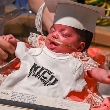 VIDEO: Baby born weighing less than 1 pound graduates from NICU after 128 days