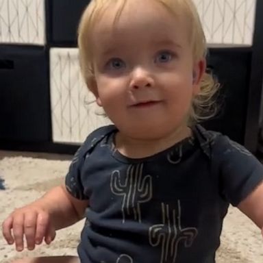 VIDEO: Toddler jams to Bob Marley after being fitted with hearing aids