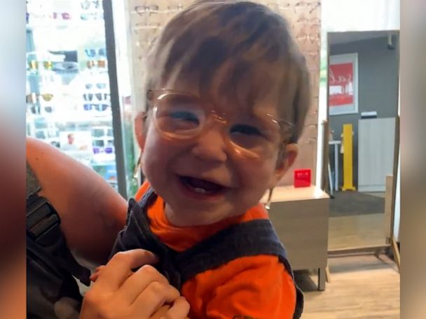 Children's hospital creates custom glasses system for child with ear  deformity - ABC News