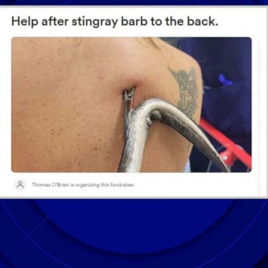 VIDEO: Woman speaks out after being ‘impaled’ by stingray in Florida