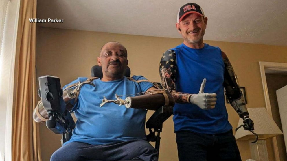 Worker who lost arms on the job inspires others | GMA