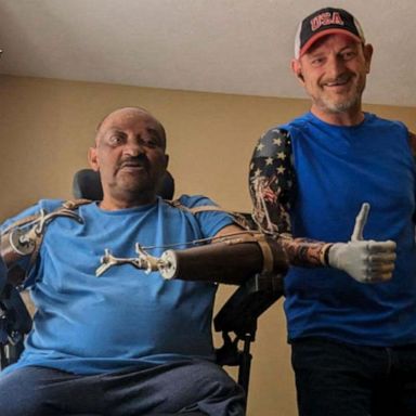 VIDEO: Worker who lost arms on the job inspires others