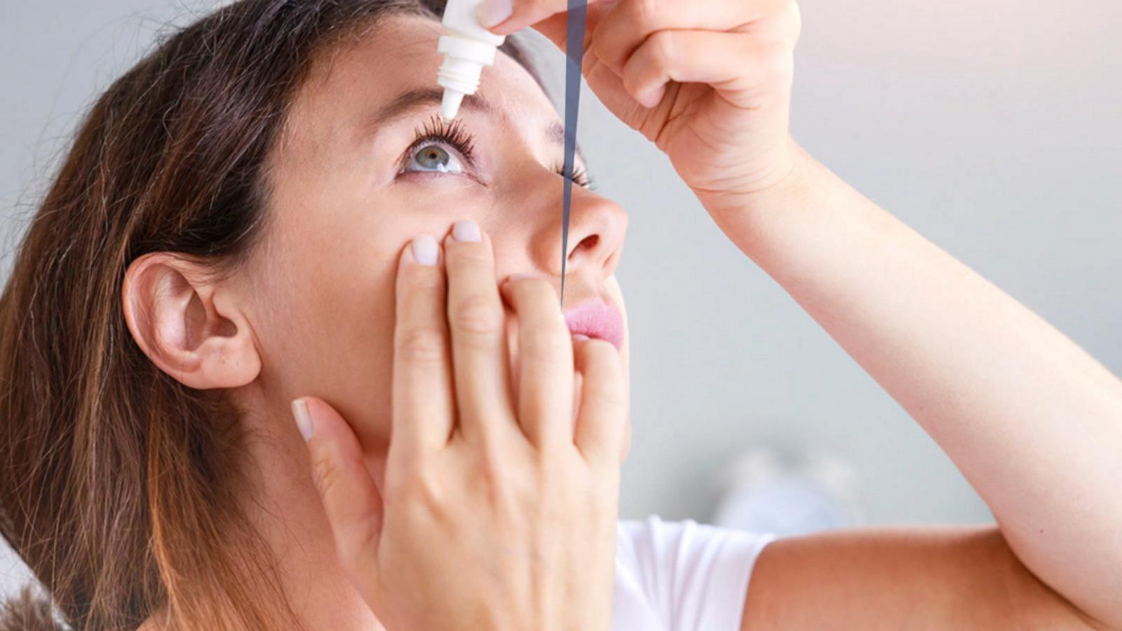 Health Notes: Puffy eyes — Beauty Bible