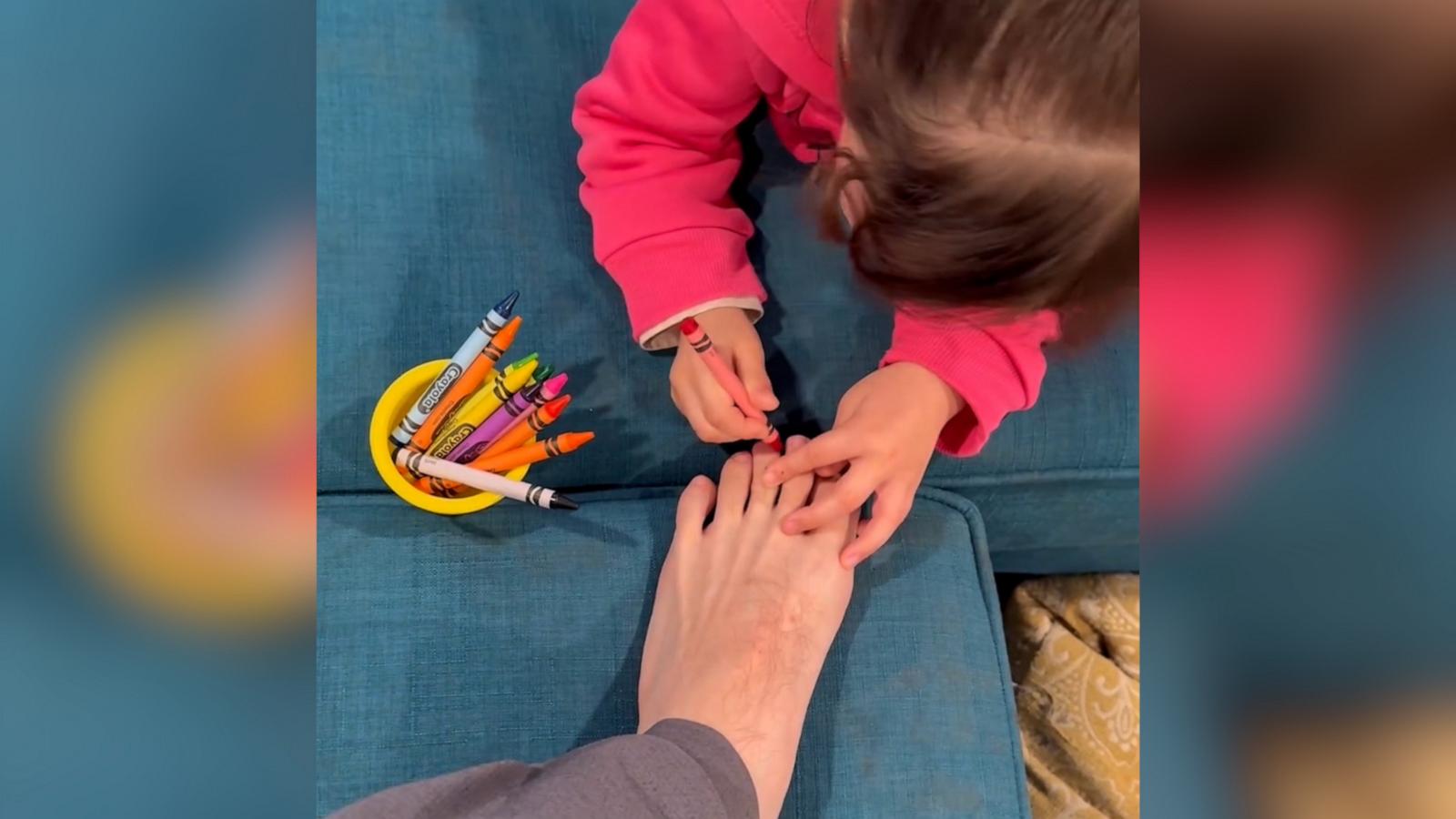 VIDEO: Dad gets crayon pedicure from toddler