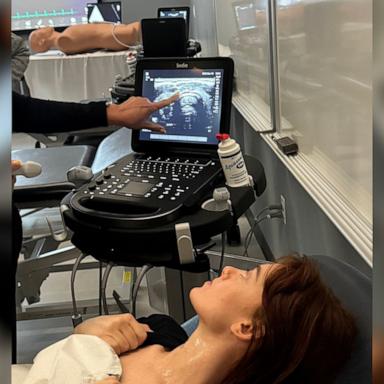 VIDEO: Medical student helps discover her own cancer in ultrasound class 