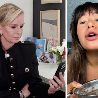 VIDEO: Can a flaxseed gel face mask give you the same results as Botox?