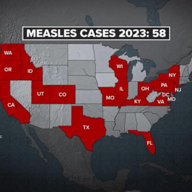 VIDEO: CDC warns health providers about the rise of measles cases