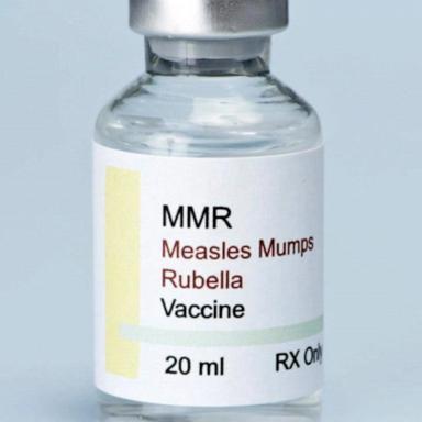 VIDEO: Latest on measles outbreak in Florida