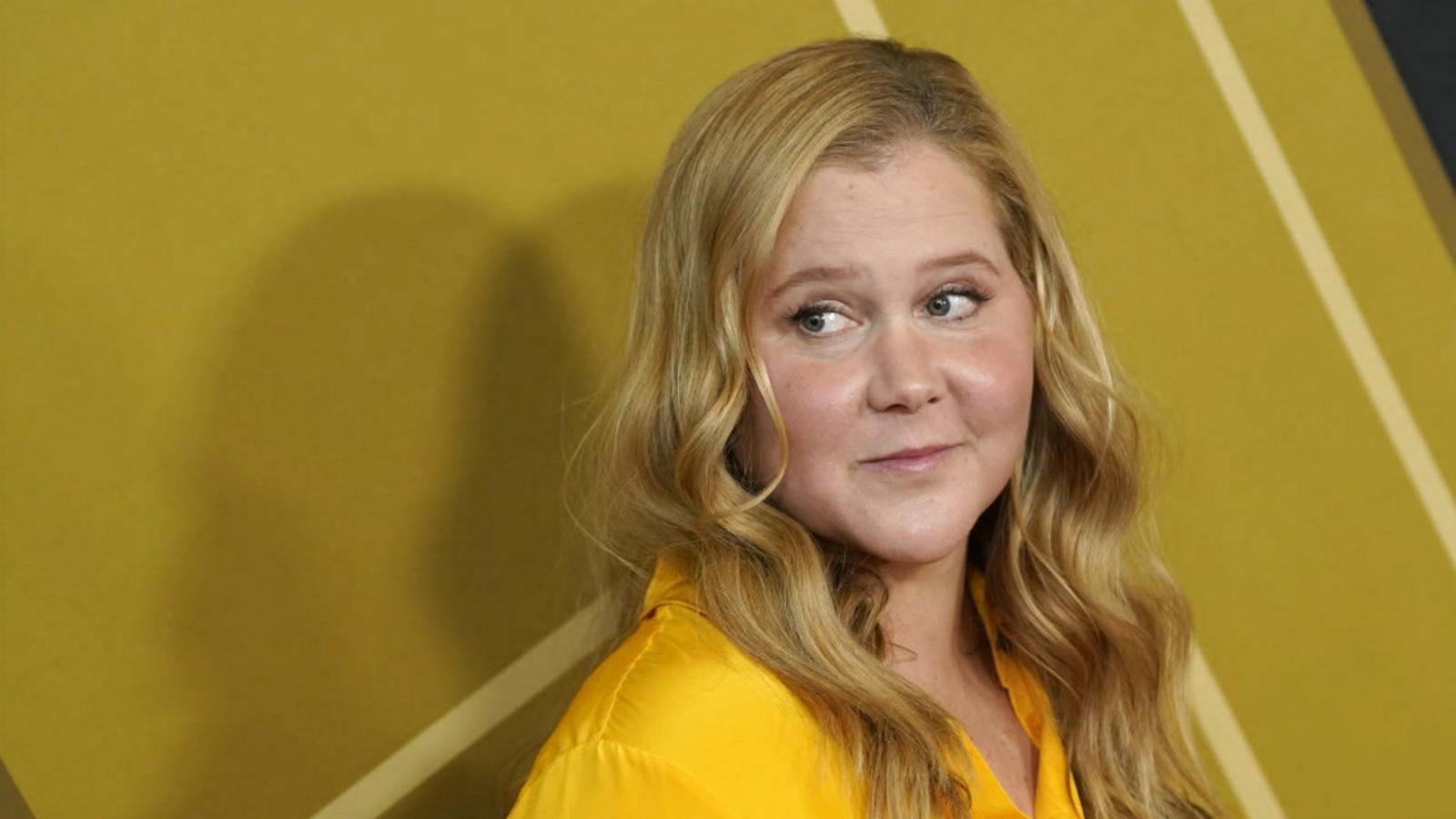 Amy Schumer opens up about Cushing Syndrome