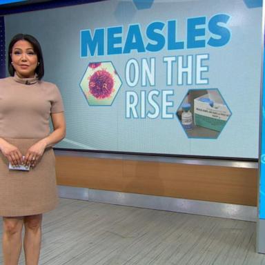 VIDEO: Measles cases on the rise in US