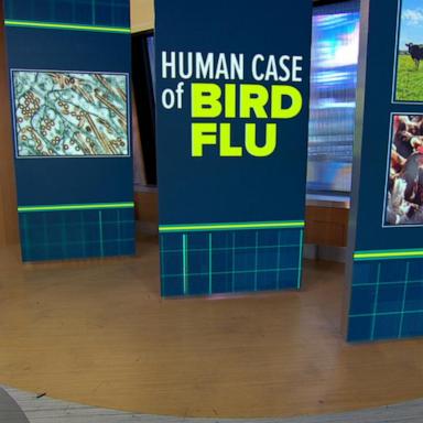 VIDEO: Human case of bird flu reported in Texas