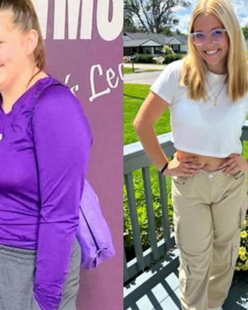 Teen shares weight-loss journey with the help of Wegovy - Good Morning  America