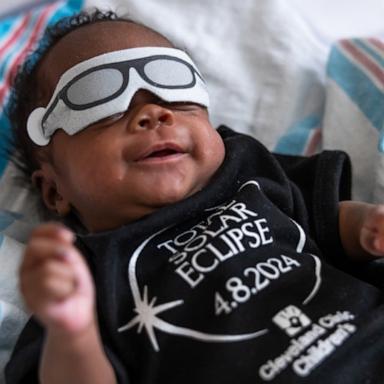 VIDEO: These NICU babies are ready for the solar eclipse 