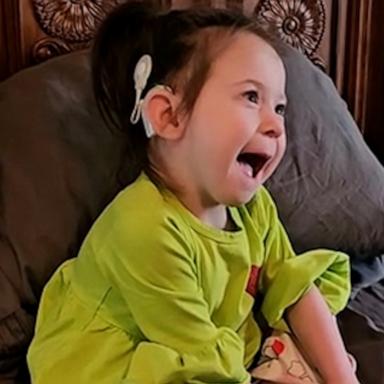 VIDEO: Little girl with cochlear implants has heartfelt reaction hearing dad's guitar 