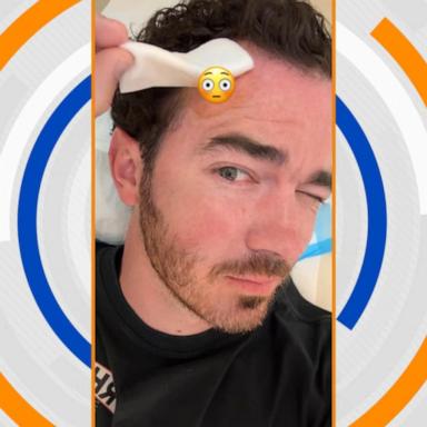 VIDEO: Kevin Jonas posts social media video having skin cancer removed