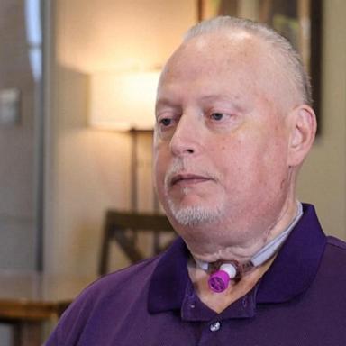 VIDEO: Cancer patient regains voice after larynx transplant