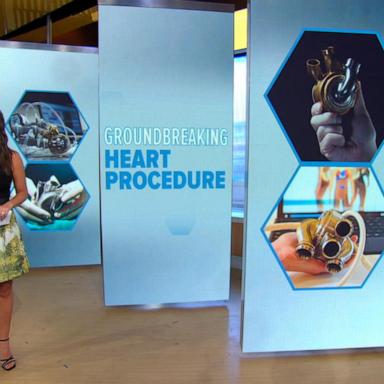 VIDEO: Doctors implant artificial heart in patient awaiting transplant