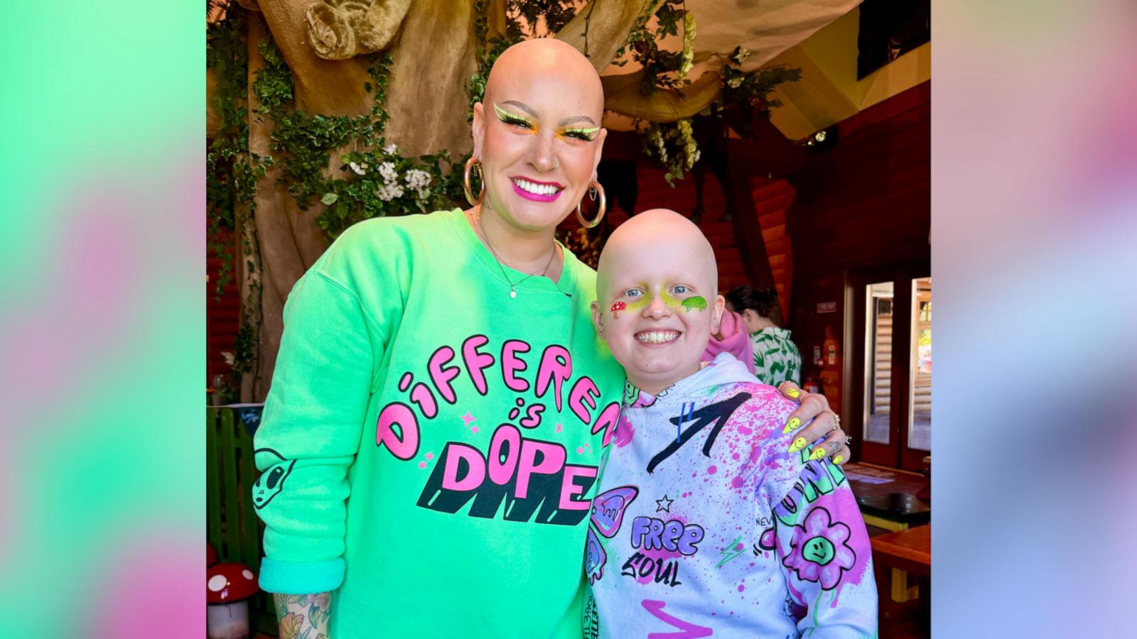 VIDEO: Watch the moment 10-year-old with alopecia goes out in public bald for 1st time