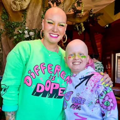 VIDEO: Watch the moment 10-year-old with alopecia goes out in public bald for 1st time