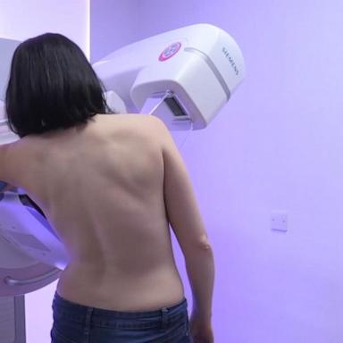 VIDEO: New mammogram rule to go into effect