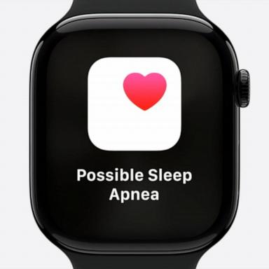 VIDEO: A look at the Apple Watch's sleep apnea detector