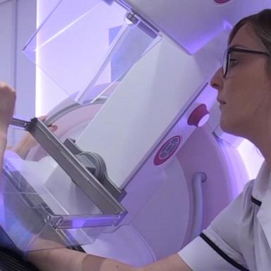 VIDEO: New study on 3D mammograms 