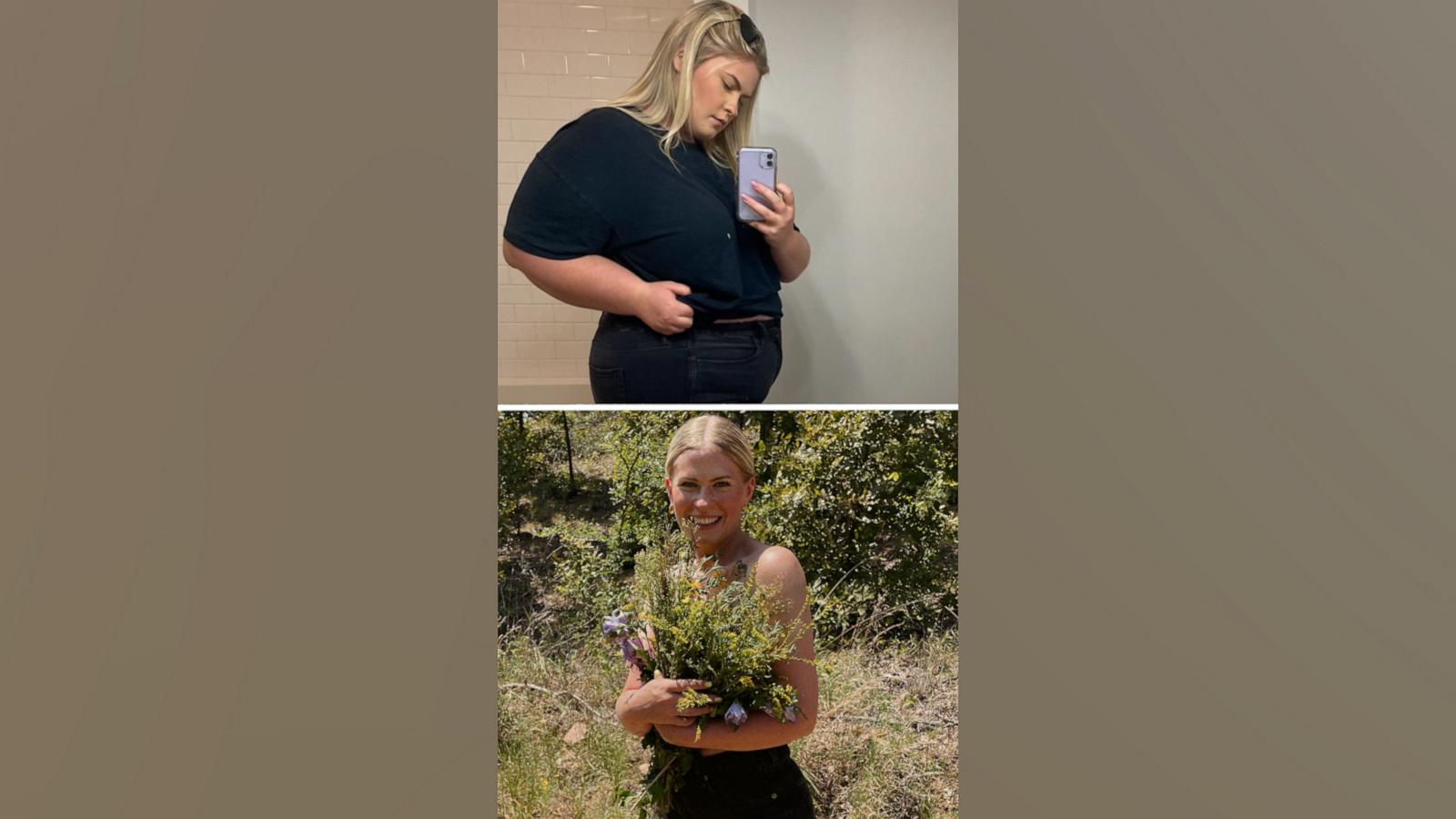 VIDEO: TikToker describes how people treated her differently after she lost 250 pounds