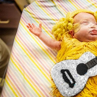 VIDEO: NICU babies dressed up for Halloween are BOO-tiful 