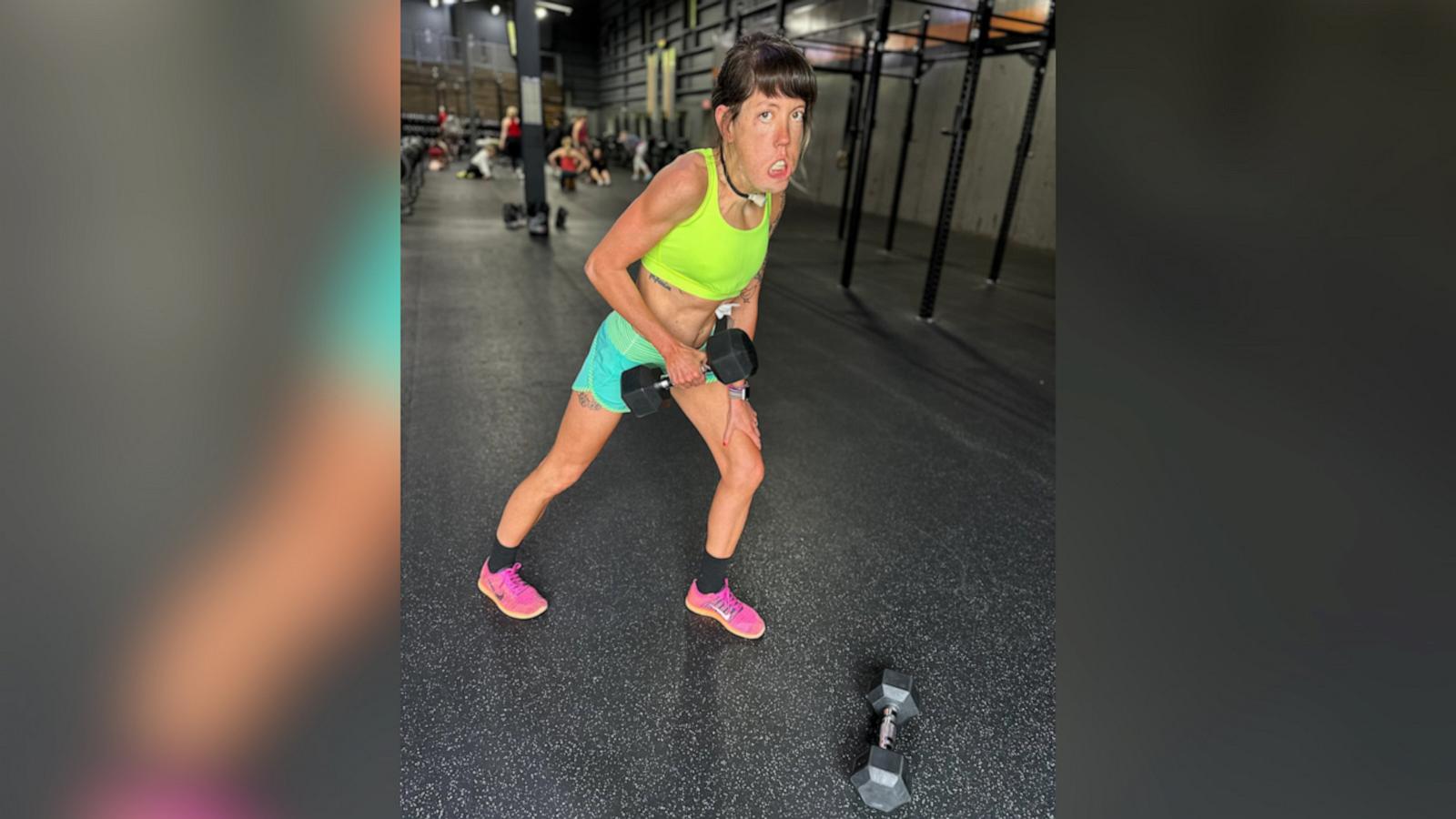 VIDEO: 34-year-old Crossfitter competes using feeding tube