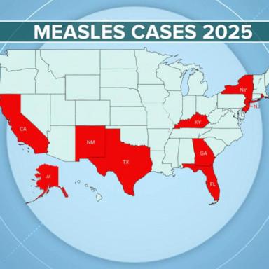 VIDEO: Unvaccinated adult in New Mexico tests positive for measles after dying