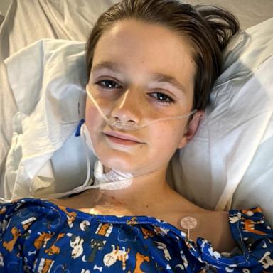 VIDEO: Child undergoes breakthrough heart procedure