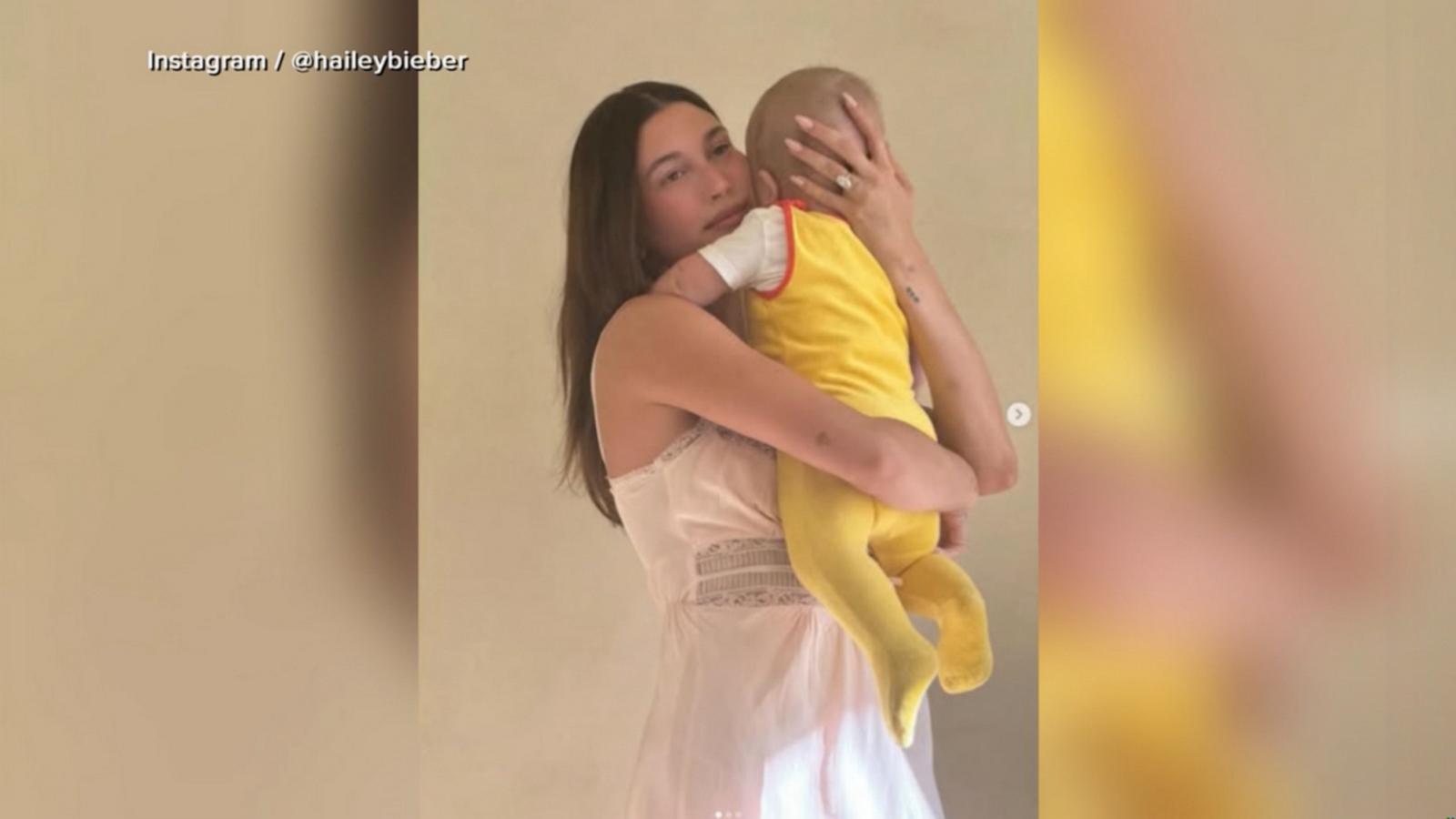 VIDEO: Hailey Bieber reveals she suffered postpartum complication